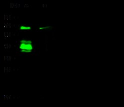Sino Biological Anti-ER alpha Antibody, Rabbit Polyclonal, Quantity: Each