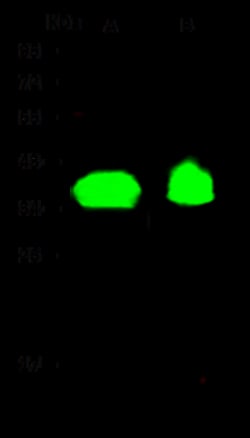 Sino Biological Anti-OR6K2 Antibody, Rabbit Polyclonal, Quantity: Each