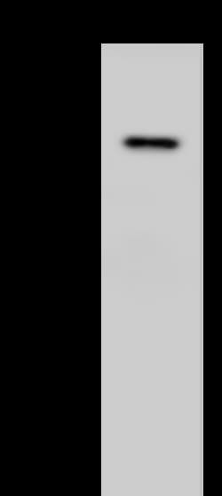 Sino Biological CHEK2 Antibody, Rabbit PAb, Antigen Affinity Purified 100µL,