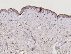 Sino Biological Anti-Kallikrein 7/KLK7 Antibody, Rabbit Polyclonal, Quantity: