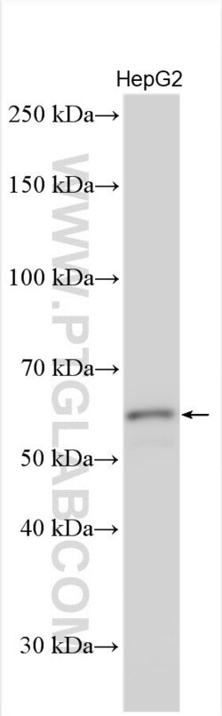 KPNA3 Rabbit, anti-Human, Polyclonal, Proteintech Quantity: 150 &mu;L:Antibodies