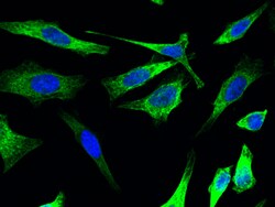 Sino Biological Anti-Cytokeratin 17 Antibody, Rabbit Polyclonal, Quantity: