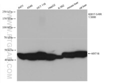 Cytokeratin 18 Rabbit, anti-Human, Clone: 4F2, Proteintech:Antibodies:Primary