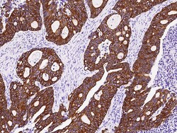 Sino Biological Anti-KRT18/Cytokeratin18 Antibody, Rabbit Polyclonal, Quantity: