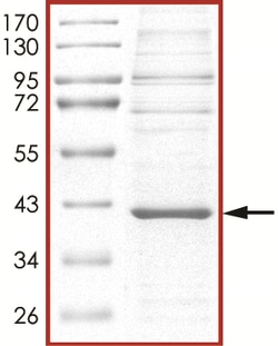 Sino Biological&nbsp;Recombinant Human LIMK1 Protein (His Tag)