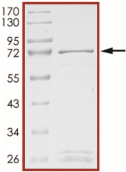 Sino Biological&nbsp;Recombinant Mouse LMTK3 Protein (GST Tag)
