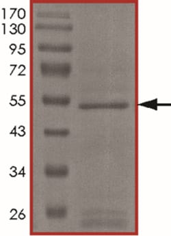 Sino Biological&nbsp;Recombinant Human LOXL3 Protein (GST Tag)