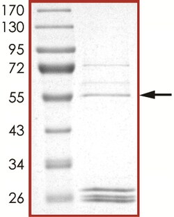 Sino Biological&nbsp;Recombinant Human LOXL4 Protein (GST Tag)