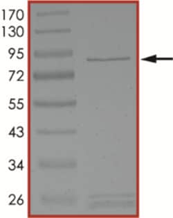 Sino Biological&nbsp;Recombinant Human LCMT2 Protein (Full Length, GST Tag)