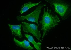 LATS1 Rabbit, anti-Human, CoraLite Plus 488, Polyclonal, Proteintech:Antibodies:Primary