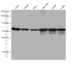 LBR Mouse, anti-Human, Clone: 1A1B7, Proteintech:Antibodies:Primary Antibodies