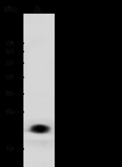 Sino Biological Anti-Lipocalin-2/NGAL Antibody, Rabbit Polyclonal, Quantity: