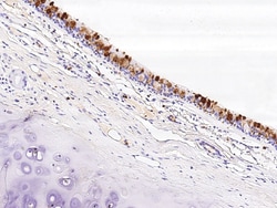 Sino Biological Anti-Lipocalin-2/NGAL Antibody, Mouse Monoclonal, Quantity:
