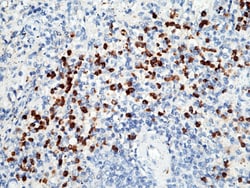 Sino Biological Anti-Lipocalin-2/NGAL Antibody, Rabbit Polyclonal, Quantity: