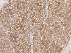 Sino Biological Anti-LDOC1 Antibody, Rabbit Polyclonal, Quantity: Each