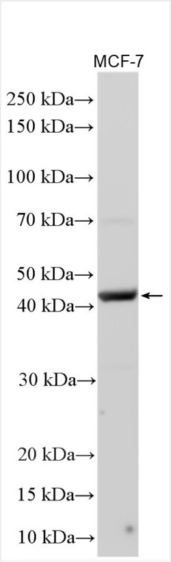 LHX8 Rabbit, anti-Human, Polyclonal, Proteintech Quantity: 150 &mu;L:Antibodies