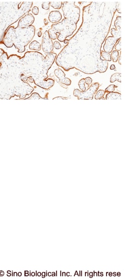 Sino Biological LIFR / CD118 Antibody, Rabbit MAb 100uL, Quantity: Each
