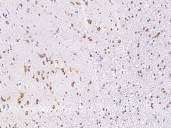 Sino Biological Anti-LINGO-1 Antibody, Rabbit Polyclonal, Quantity: Each