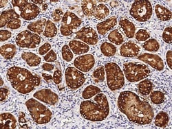 Sino Biological gastric lipase / LIPF Antibody, Rabbit PAb, Antigen Affinity