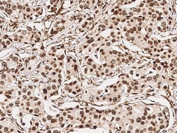 Sino Biological Anti-Loricrin/LOR Antibody, Rabbit Polyclonal, Quantity:
