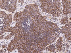 Sino Biological Anti-LPPR4 Antibody, Rabbit Polyclonal, Quantity: Each