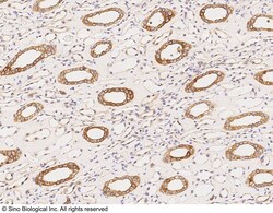 Sino Biological Anti-LRP-6 Antibody, Rabbit Polyclonal, Quantity: Each