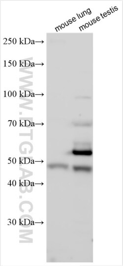 LRRC6 Rabbit, anti-Human, Polyclonal, Proteintech Quantity: 150 &mu;L:Antibodies