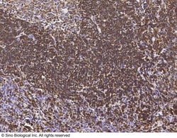 Sino Biological LSP1 Antibody, Rabbit PAb, Antigen Affinity Purified 100uL,