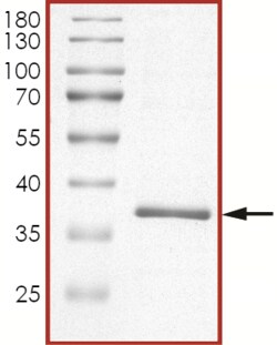 Sino Biological&nbsp;Recombinant Human MEK3/MAP2K3 Protein (Full Length, His Tag)