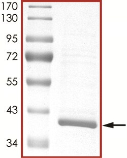 Sino Biological&nbsp;Recombinant Human MKK6 Protein (Full Length, His Tag)