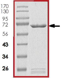 Sino Biological&nbsp;Recombinant Human MAP3K8 Protein (GST Tag)