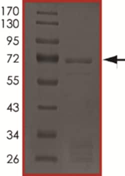 Sino Biological&nbsp;Recombinant Human ERK1/MAPK3 Protein (Full Length, GST Tag)