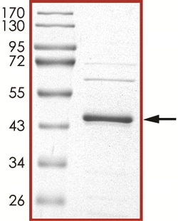 Sino Biological&nbsp;Recombinant Human ERK1/MAPK3 Protein (Full Length)