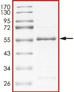 Sino Biological&nbsp;Recombinant Human PRAK/MAPKAPK5 Protein (Full Length, His Tag)