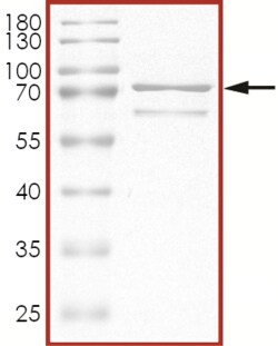 Sino Biological&nbsp;Recombinant Human PRAK/MAPKAPK5 Protein (Full Length, GST Tag)