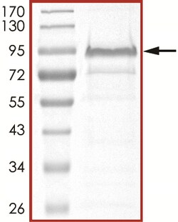 Sino Biological&nbsp;Recombinant Human MDM2 Protein (GST Tag)