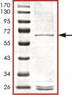 Sino Biological&nbsp;Recombinant Human MOS Protein (Full Length, GST Tag)