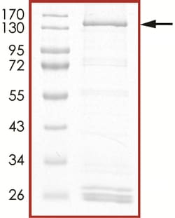 Sino Biological&nbsp;Recombinant Human MASTL/THC2 Protein (Full Length, GST Tag)