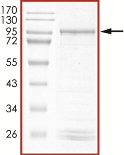 Sino Biological&nbsp;Recombinant Human MYCN Protein (Full Length, GST Tag)