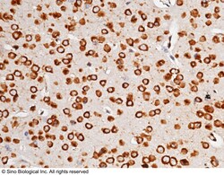 Sino Biological AGO2 / Argonaute 2 / EIF2C2 Antibody, Rabbit MAb 100uL,
