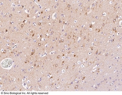 Sino Biological LC3A / MAP1LC3A Antibody, Rabbit PAb, Antigen Affinity