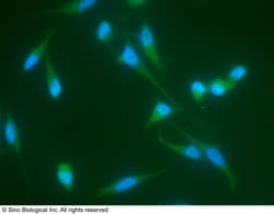 Sino Biological JNK2 / MAPK9 Antibody, Rabbit MAb 100uL, Quantity: Each