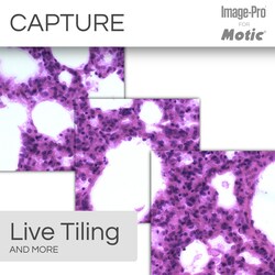 Motic Clinical Package: PA43BIO Trino (Pathology) Upright Microscope w/