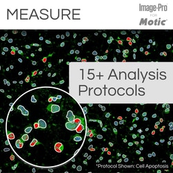 Motic Clinical (Fluorescence) Package: PA53 BIO FS6 Upright Microscope