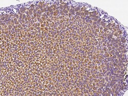Sino Biological Anti-B4GALT6 Antibody, Rabbit Polyclonal, Quantity: Each