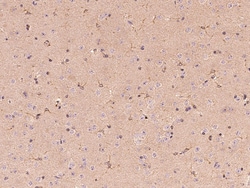 Sino Biological Butyrylcholinesterase/BCHE Antibody, Rabbit PAb, Antigen