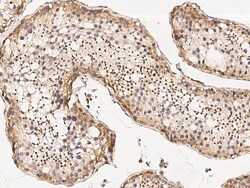 Sino Biological Anti-MBD3L1 Antibody, Rabbit Polyclonal, Quantity: Each