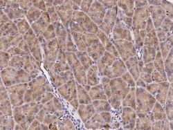 Sino Biological Anti-TEM-1/CD248 Antibody, Rabbit Polyclonal, Quantity: