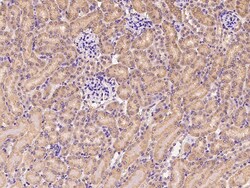 Sino Biological Anti-Cdc25B Antibody, Rabbit Polyclonal, Quantity: Each