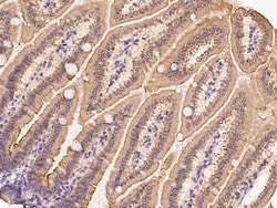 Sino Biological Anti-CIDE B Antibody, Rabbit Polyclonal, Quantity: Each